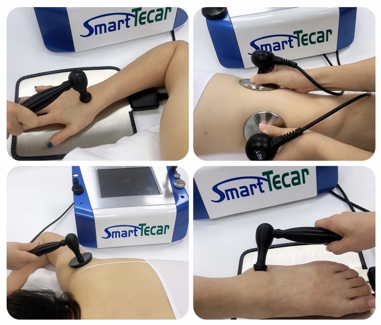 Smart Tecar Physical Therapy Machine CET RET Energy Transfer RF Diathermy Device for Muscle Pain Relief Cellulite Reduce